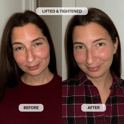 Lacto-PDRN* 4% + B9 Eye Cream