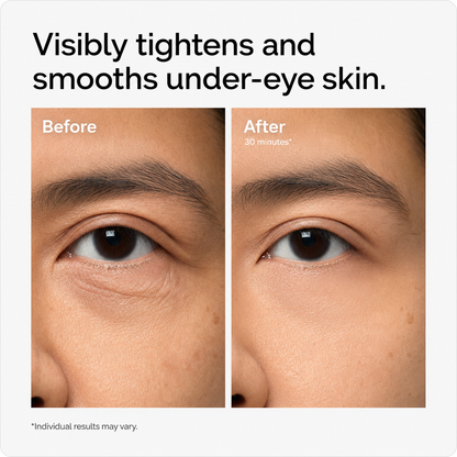 Lacto-PDRN* 4% + B9 Eye Cream