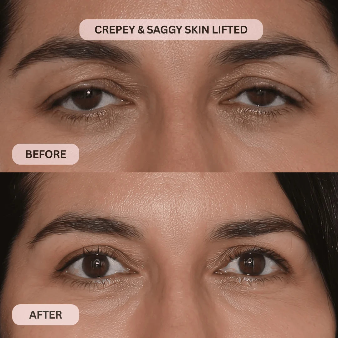 Lacto-PDRN* 4% + B9 Eye Cream