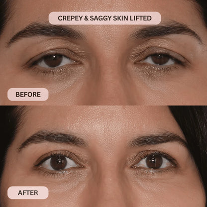 Lacto-PDRN* 4% + B9 Eye Cream